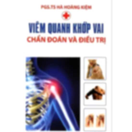 Viêm Quanh Khớp Vai - Chẩn Đoán Và Điều Trị