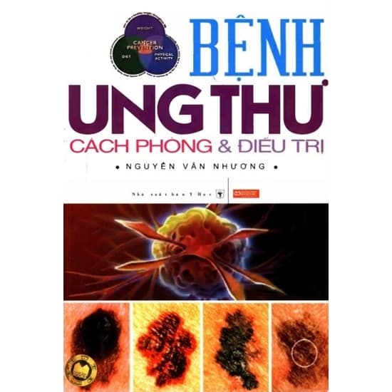 Bệnh ung thư cách phòng và điều trị